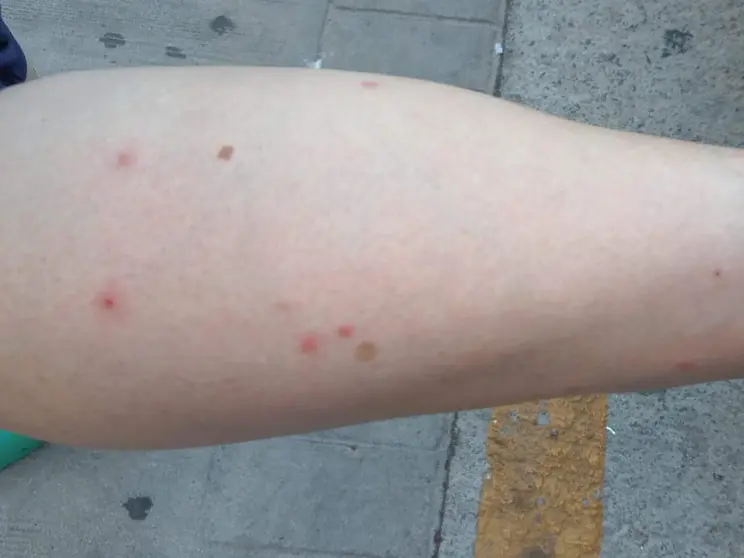 As&iacute; qued&oacute; la pierna de una de las vecinas / Cedida