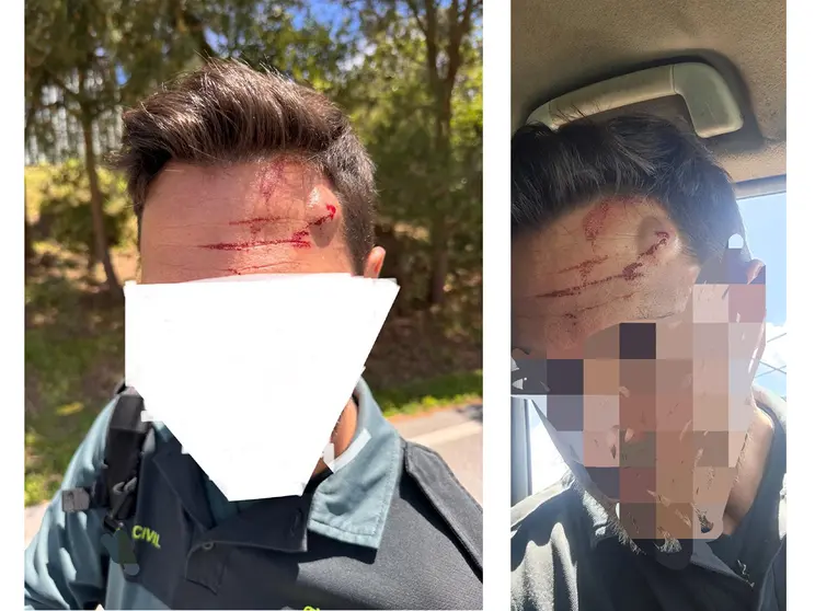 Guardia Civil agredido en la frontera
