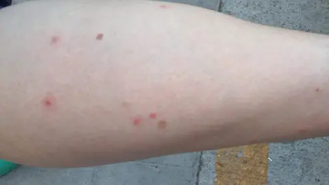 As&iacute; qued&oacute; la pierna de una de las vecinas / Cedida