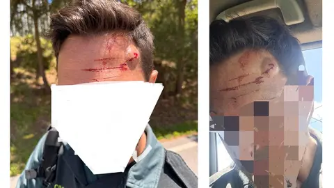 Guardia Civil agredido en la frontera