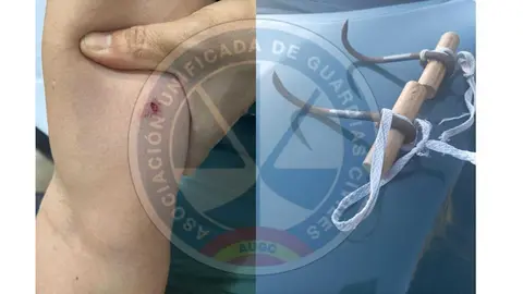 "Intento de homicidio en la frontera": un guardia civil herido tras un ataque con un garfio / AUGC